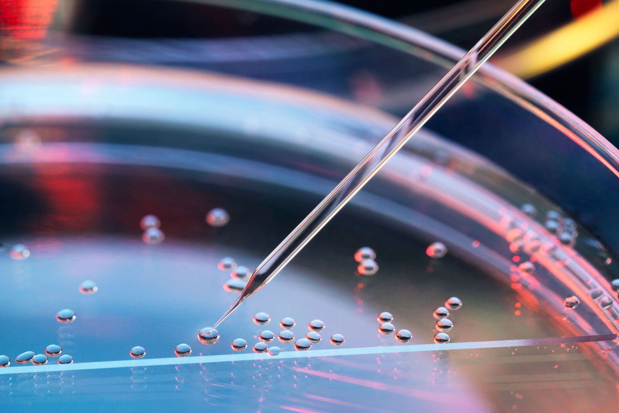 Stem cell research, nuclear transfer being carried out on several embryonic stem cells for cloning