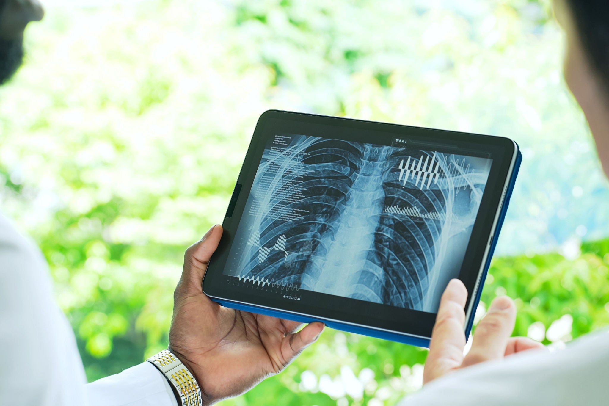 EY-Parthenon report at BioAsia 2026