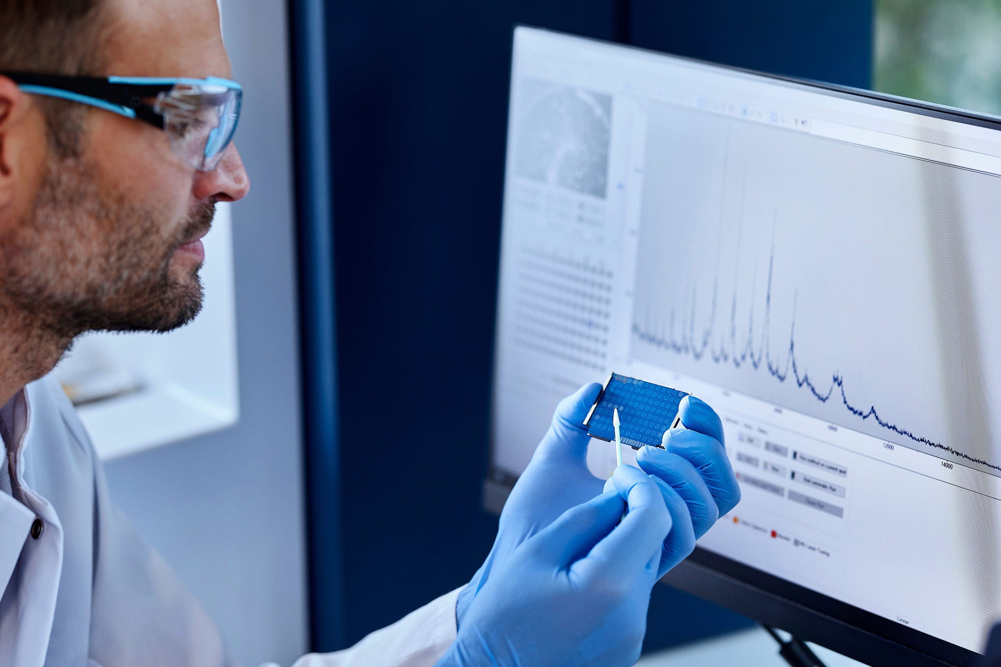 Scientist analyzing sample in a microbiological lab