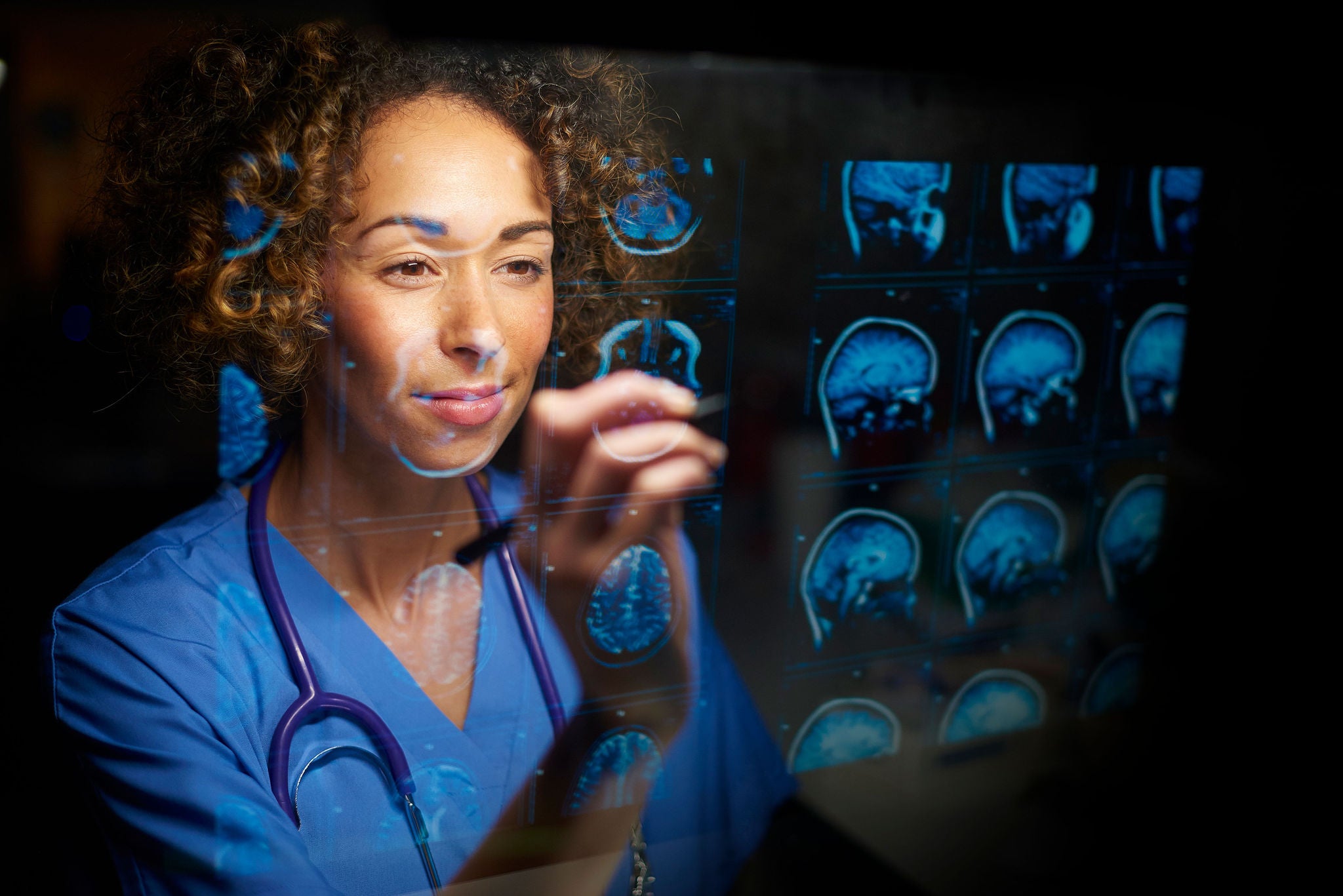 doctor analysing scans human brain