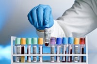 La esteatohepatitis no alcohólica (NASH) EY España