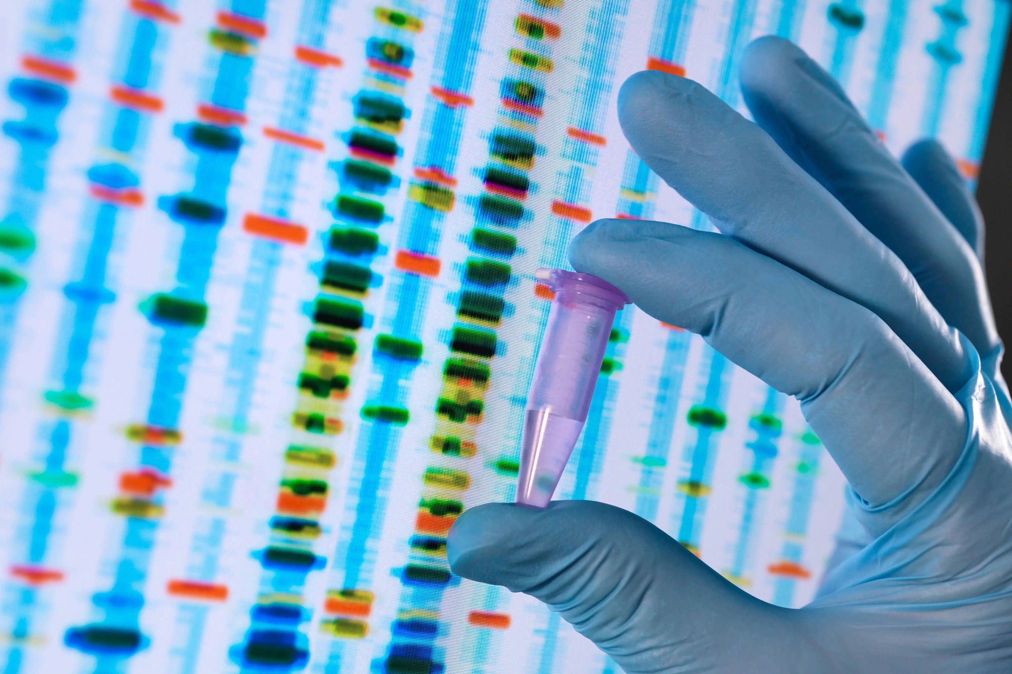 Scientist holding a DNA sample with the results on a computer sceeen in a laboratory